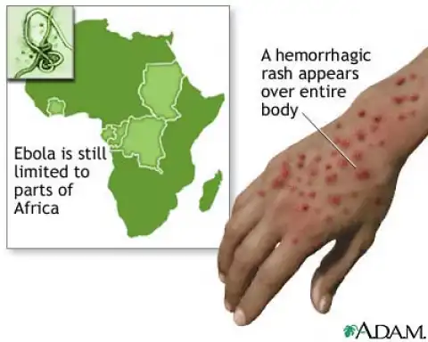Ebola outbreak: Liberian man dies in quarantine in Nigeria